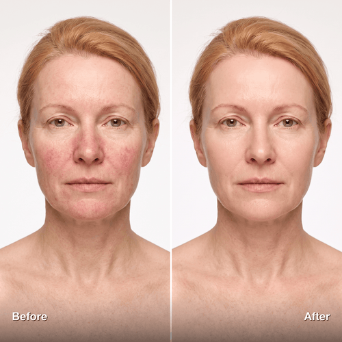 CC Color-Correcting Tinted Serum