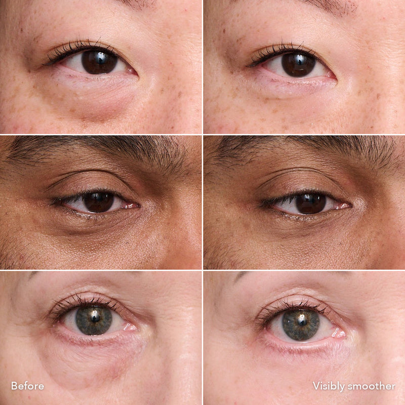 Instant Eye Tightener