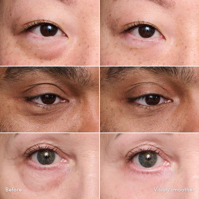 Instant Eye Tightener