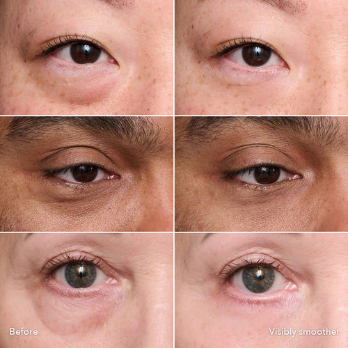 Instant Eye Tightener