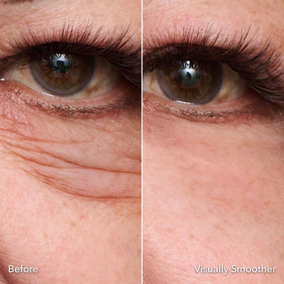 Instant Eye Tightener